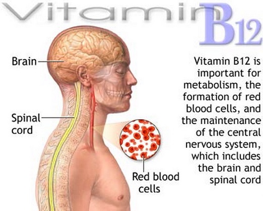 Vitamin B12 deficiency