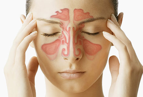 Symptoms of Sinusitis