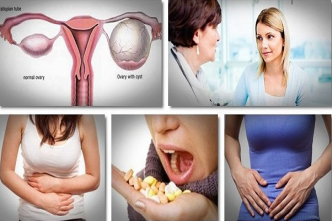 Home Remedies For Ovarian Cysts