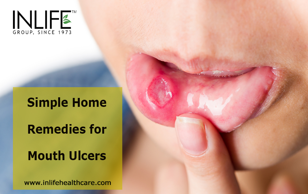 Simple Home Remedies For Mouth Ulcers