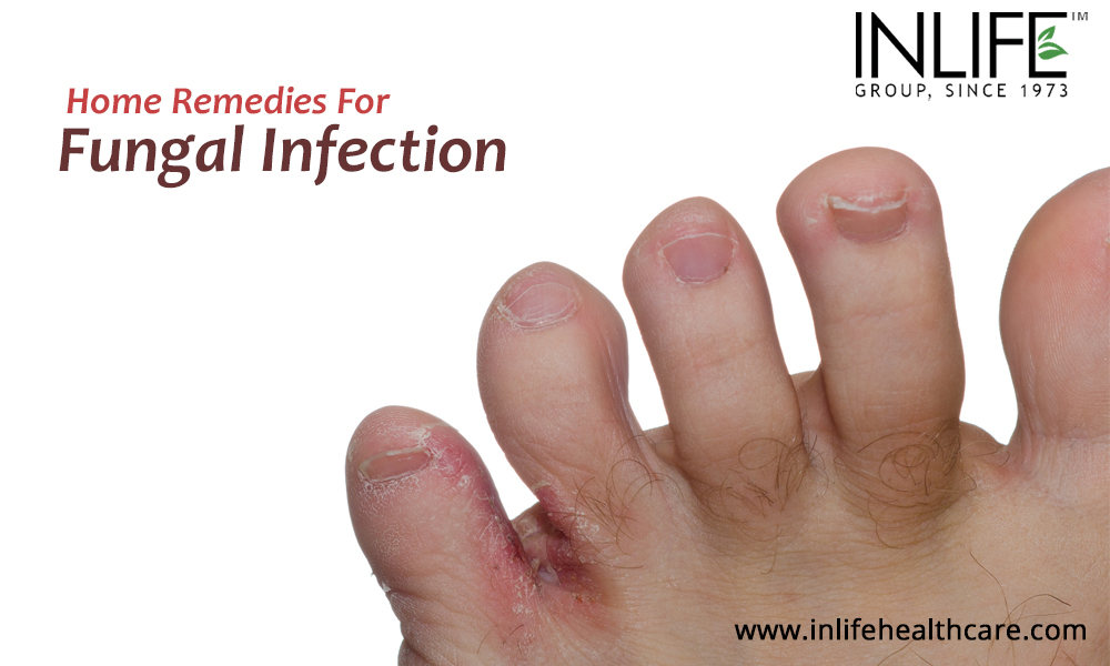Home Remedies For Fungal Infection