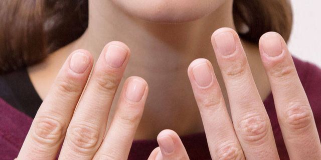 Methods to Reduce Onychorrhexis or Brittle Nails - InlifeHealthCare
