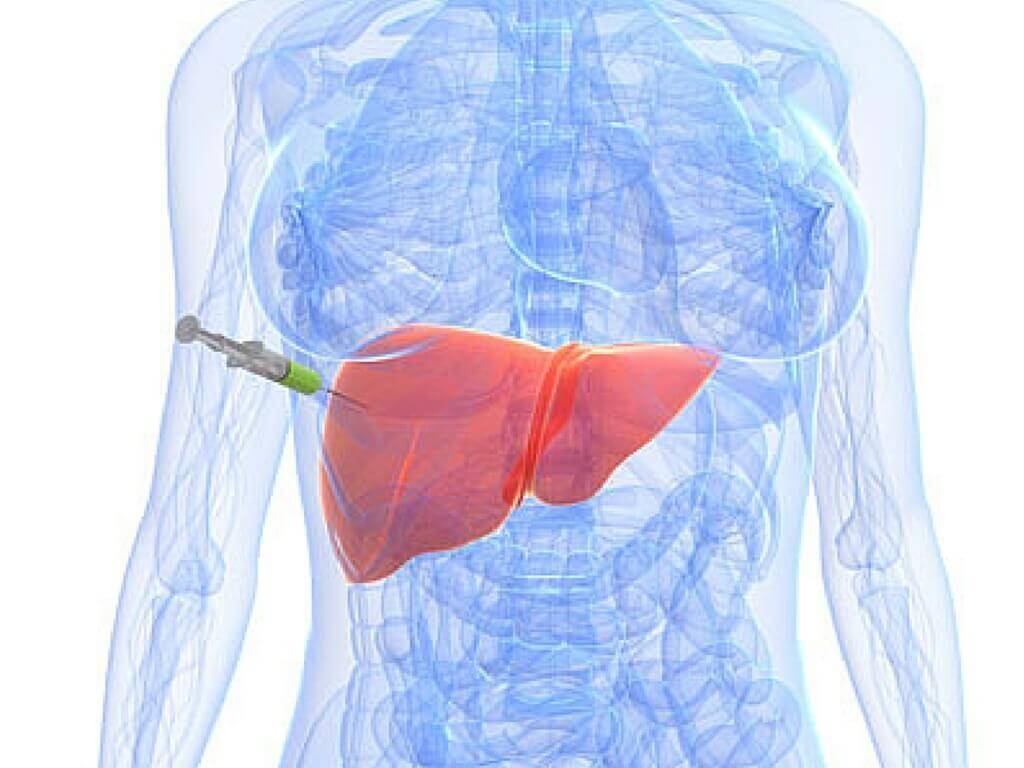 What Are Liver Function Tests and When Should You Get One
