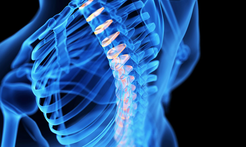 Is a healthy spine crucial to combat your back pain?