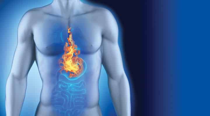 List of food you shouldn't eat if you have heart burn or acid reflux