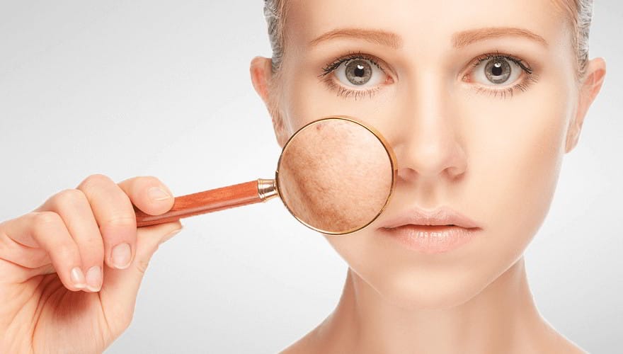 Home Remedies For Pigmented Skin