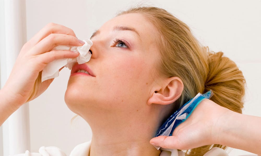 Amazing Home Remedies To Stop Nose Bleeding
