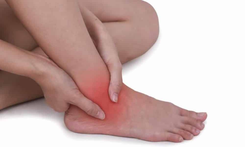 Home Remedies To Treat Edema