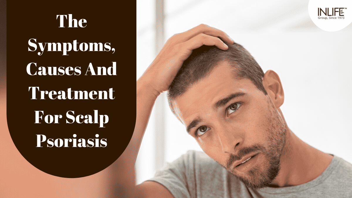 The Symptoms, Causes And Treatment For Scalp Psoriasis